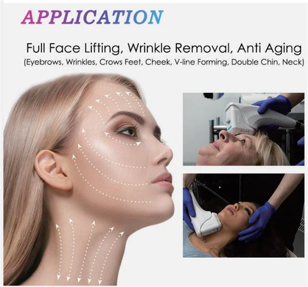 Multi-functional 4D HIFU Machine With 1 Shot 12 Lines Which Is Used For Facial And Body Anti-aging