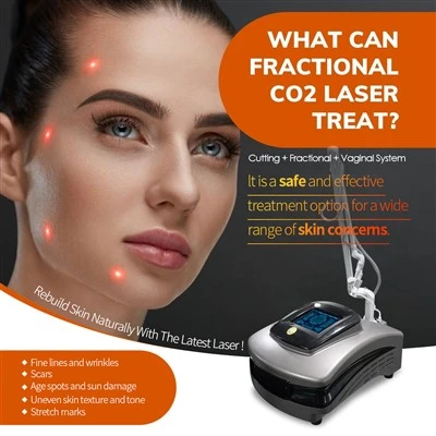 Nejnovější resurfacing laserového stroje CO2 Laser